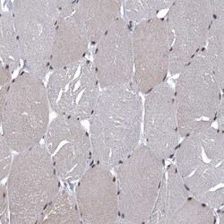 Invitrogen SENP7 Polyclonal Antibody 100 &mu;L; Unconjugated:Antibodies,