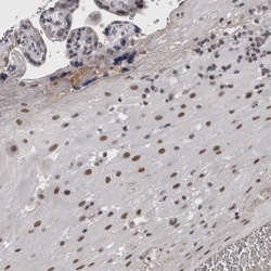 Invitrogen BRCAA1 Polyclonal Antibody 100 &mu;L; Unconjugated:Antibodies,