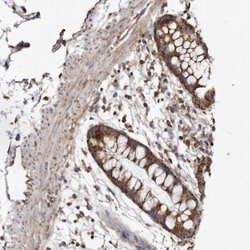 Invitrogen Fumarase Polyclonal Antibody 100 &mu;L; Unconjugated:Antibodies,