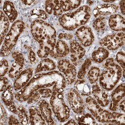 Invitrogen Fumarase Polyclonal Antibody 100 &mu;L; Unconjugated:Antibodies,