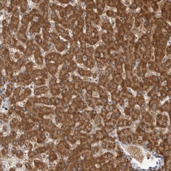 Invitrogen Fumarase Polyclonal Antibody 100 &mu;L; Unconjugated:Antibodies,