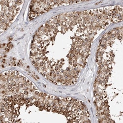 Invitrogen Fumarase Polyclonal Antibody 100 &mu;L; Unconjugated:Antibodies,