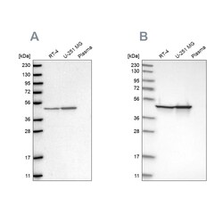 Invitrogen Fumarase Polyclonal Antibody 100 &mu;L; Unconjugated:Antibodies,
