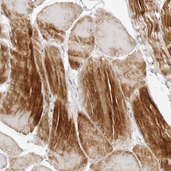 Invitrogen MEK5 Polyclonal Antibody 100 &mu;L; Unconjugated:Antibodies,