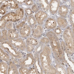 Invitrogen HTRA2 Polyclonal Antibody 100 &mu;L; Unconjugated:Antibodies,