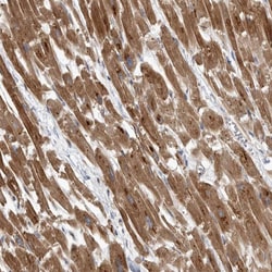 Invitrogen PDK1 Polyclonal Antibody 100 &mu;L; Unconjugated:Antibodies,