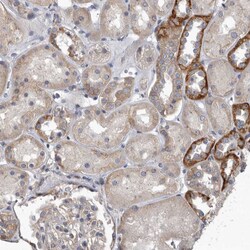 Invitrogen PDK1 Polyclonal Antibody 100 &mu;L; Unconjugated:Antibodies,