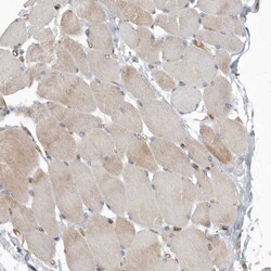 Invitrogen PDK1 Polyclonal Antibody 100 &mu;L; Unconjugated:Antibodies,