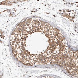 Invitrogen ORP9 Polyclonal Antibody 100 &mu;L; Unconjugated:Antibodies,