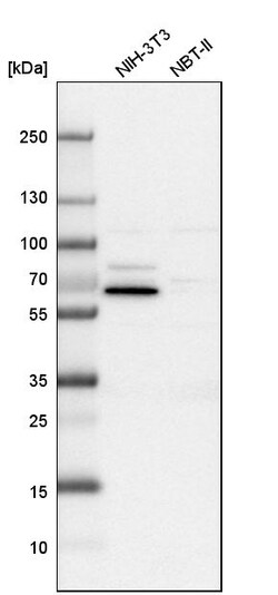 Invitrogen USH1C Polyclonal Antibody 100 &mu;L; Unconjugated:Antibodies,