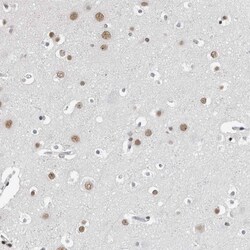 ORC1 Polyclonal Antibody:Antibodies, Polyclonal