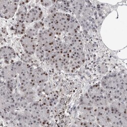 ORC1 Polyclonal Antibody:Antibodies, Polyclonal