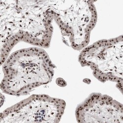 ORC1 Polyclonal Antibody:Antibodies, Polyclonal