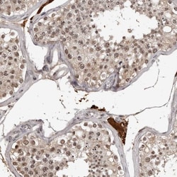 ORC1 Polyclonal Antibody:Antibodies, Polyclonal