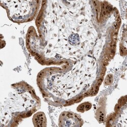 Invitrogen NAB2 Polyclonal Antibody 100 &mu;L; Unconjugated:Antibodies,
