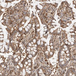 Invitrogen Annexin A11 Polyclonal Antibody 100 &mu;L; Unconjugated:Antibodies,
