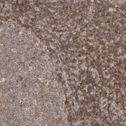 Invitrogen Annexin A11 Polyclonal Antibody 100 &mu;L; Unconjugated:Antibodies,