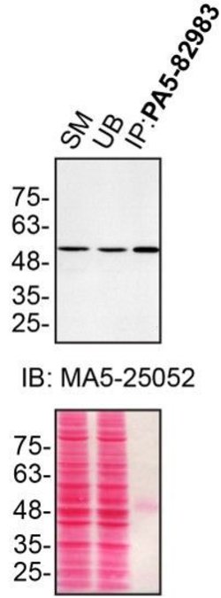 Invitrogen Annexin A11 Polyclonal Antibody 100 &mu;L; Unconjugated:Antibodies,