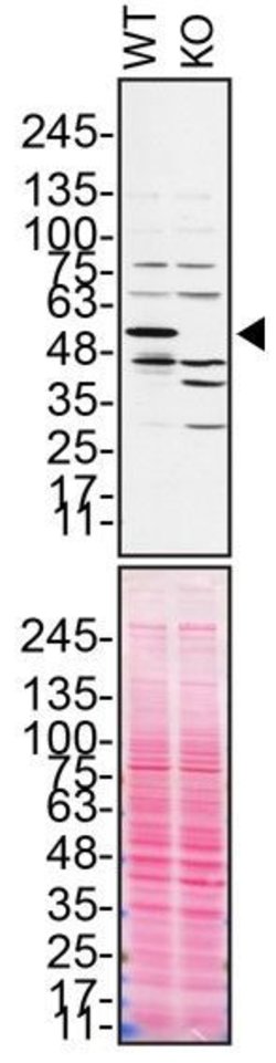 Invitrogen Annexin A11 Polyclonal Antibody 100 &mu;L; Unconjugated:Antibodies,