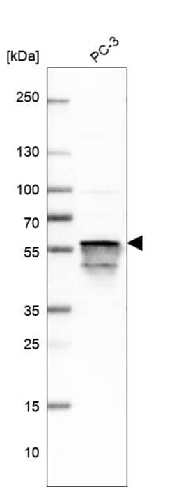 Invitrogen Annexin A11 Polyclonal Antibody 100 &mu;L; Unconjugated:Antibodies,