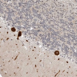 PPP2R5C Polyclonal Antibody:Antibodies, Polyclonal