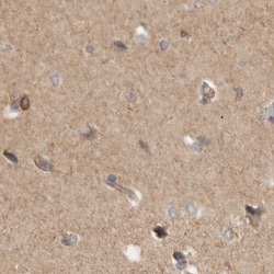 HIP55 Polyclonal Antibody:Antibodies, Polyclonal