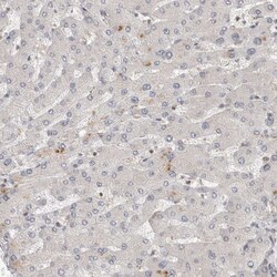 HIP55 Polyclonal Antibody:Antibodies, Polyclonal