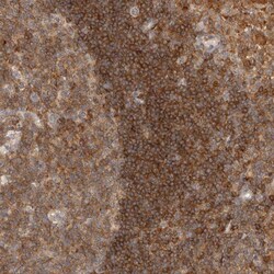 HIP55 Polyclonal Antibody:Antibodies, Polyclonal