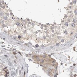 HIP55 Polyclonal Antibody:Antibodies, Polyclonal