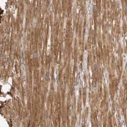 MEK5 Polyclonal Antibody:Antibodies, Polyclonal