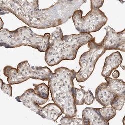 MEK5 Polyclonal Antibody:Antibodies, Polyclonal
