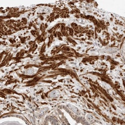 MEK5 Polyclonal Antibody:Antibodies, Polyclonal