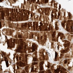 MEK5 Polyclonal Antibody:Antibodies, Polyclonal