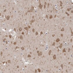 Invitrogen GSK3B Polyclonal Antibody 100 &mu;L | Buy Online | Invitrogen&trade; | Fisher Scientific