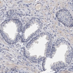 Invitrogen Spectrin alpha-1 Polyclonal Antibody 100 &mu;L; Unconjugated:Antibodies,