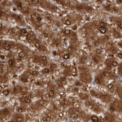 Invitrogen RBKS Polyclonal Antibody 100 &mu;L; Unconjugated:Antibodies,