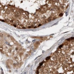 Invitrogen RBKS Polyclonal Antibody 100 &mu;L; Unconjugated:Antibodies,