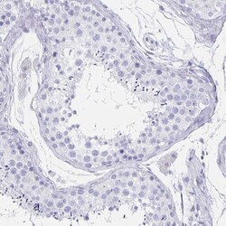 Invitrogen CCDC17 Polyclonal Antibody 100 &mu;L; Unconjugated:Antibodies,