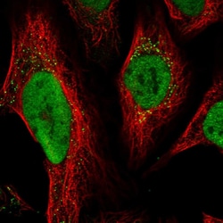 Invitrogen MSH6 Polyclonal Antibody 100 &mu;L; Unconjugated:Antibodies,
