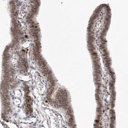 Invitrogen MSH6 Polyclonal Antibody 100 &mu;L; Unconjugated:Antibodies,