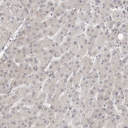 Invitrogen MSH6 Polyclonal Antibody 100 &mu;L; Unconjugated:Antibodies,