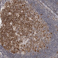 Invitrogen MSH6 Polyclonal Antibody 100 &mu;L; Unconjugated:Antibodies,