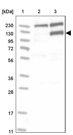 Invitrogen MSH6 Polyclonal Antibody 100 &mu;L; Unconjugated:Antibodies,