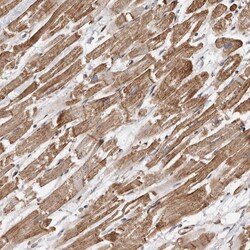 Invitrogen GSK3 alpha Polyclonal Antibody 100 &mu;L | Buy Online | Invitrogen&trade; | Fisher Scientific