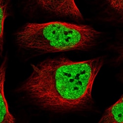 Torc2 Polyclonal Antibody:Antibodies, Polyclonal