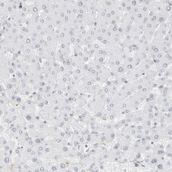 Torc2 Polyclonal Antibody:Antibodies, Polyclonal