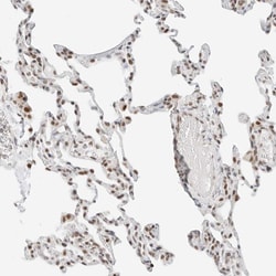 Torc2 Polyclonal Antibody:Antibodies, Polyclonal