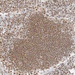 Torc2 Polyclonal Antibody:Antibodies, Polyclonal