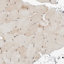 Torc2 Polyclonal Antibody:Antibodies, Polyclonal