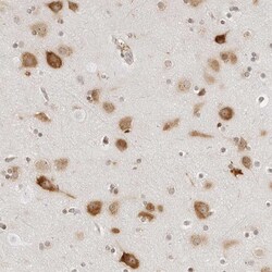 Invitrogen eIF4G Polyclonal Antibody 100 &mu;L; Unconjugated:Antibodies,